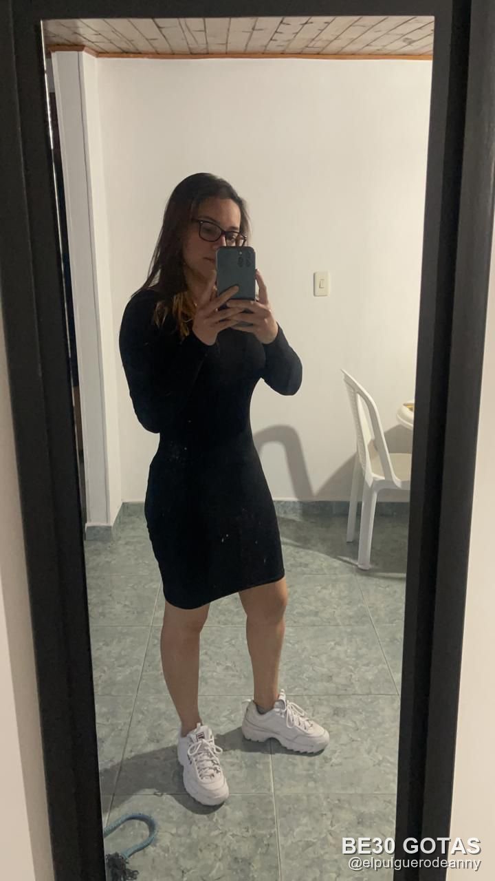 Anny después con BE30 Gotas — foto 2