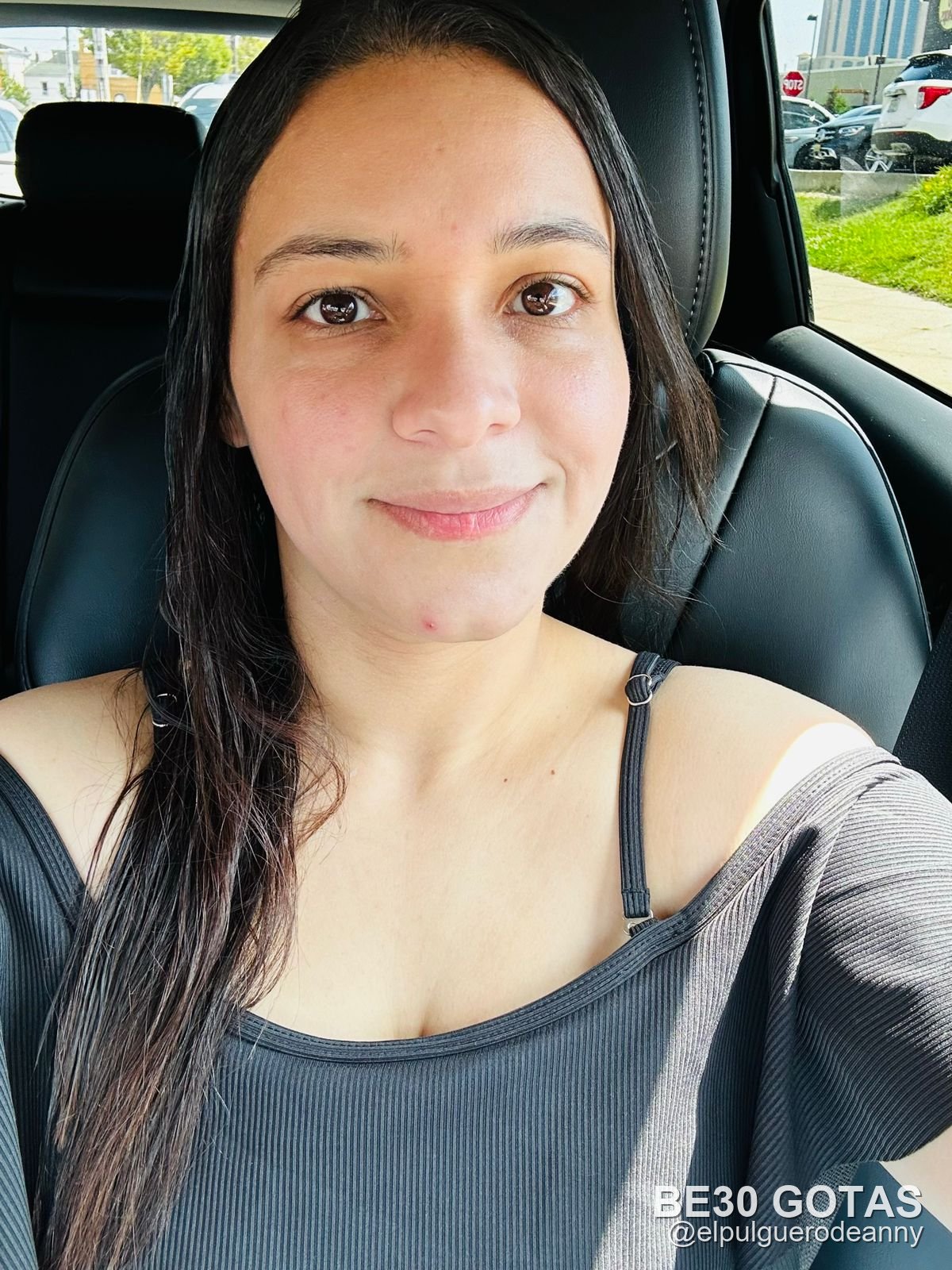 Anny después con BE30 Gotas — foto 12